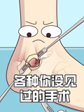 各种你没见过的手术